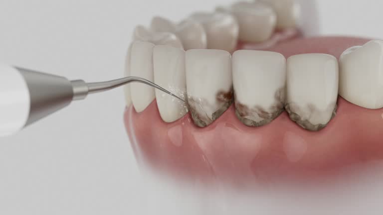 Trusted Teeth Cleaning And Checkup service in Gibbsboro, NJ - Dentist Open Now